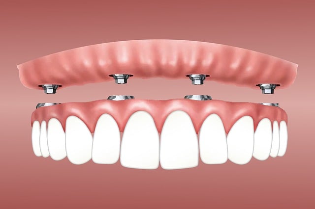 dental implant waco