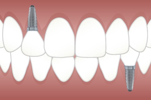 dental implant repair near me